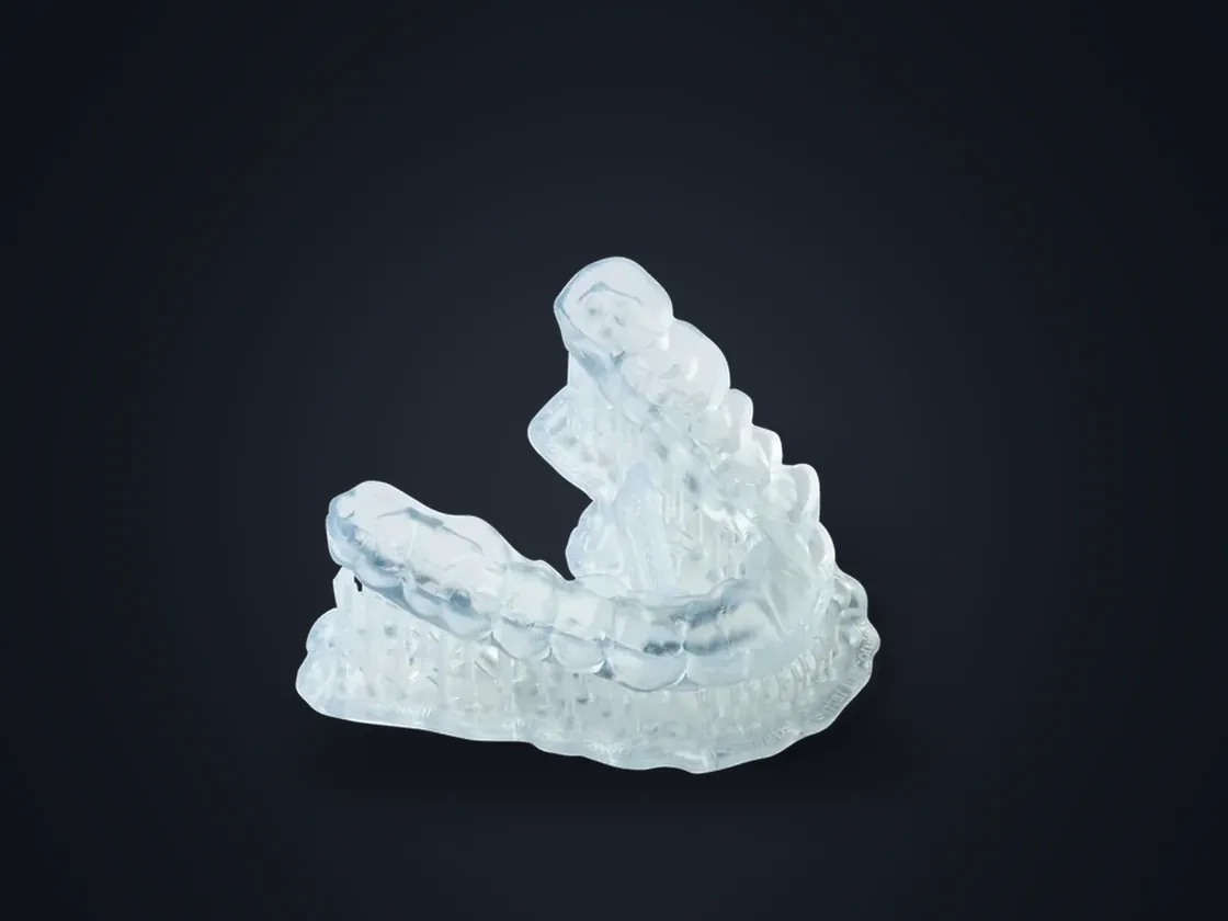 Clear splint printed in Dental LT Comfort resin, seated on a 3D printed dental model