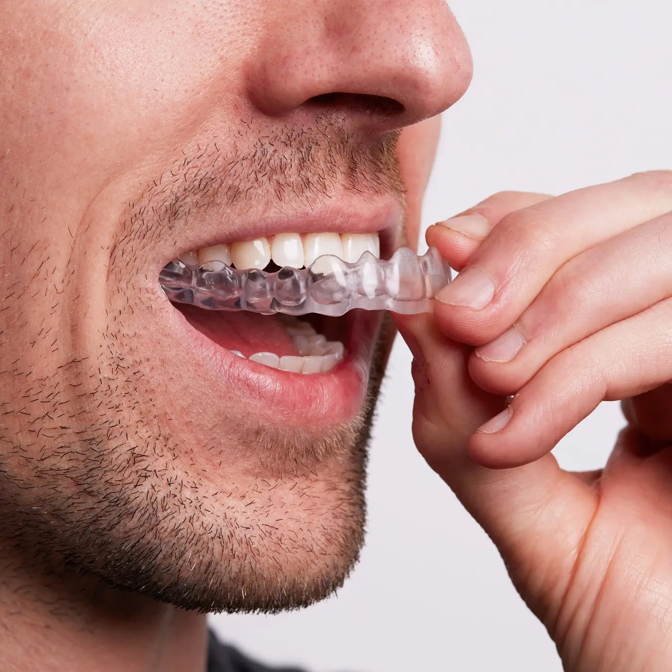 Dental models on a Formlabs 3D printer